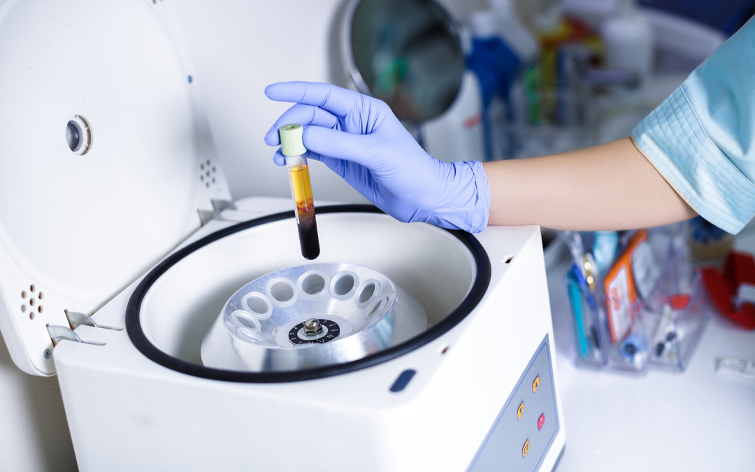 Veterinary technician preparing platelet rich plasma sample in centrifuge